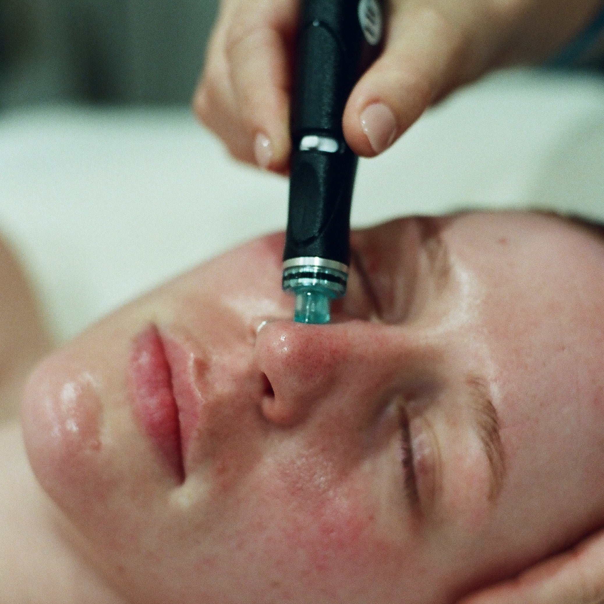 Facial Massage for Acne: Myth or Miracle?