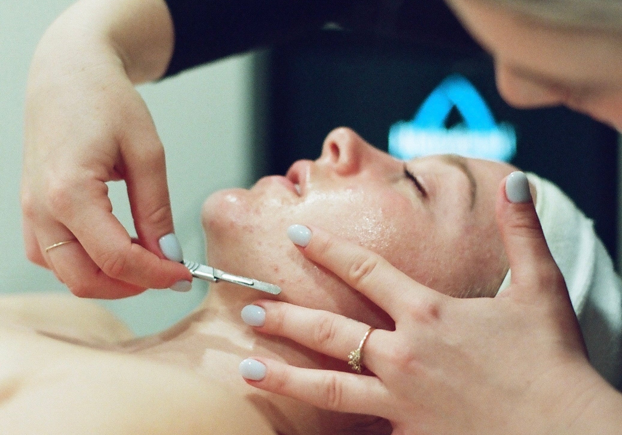 Dermaplaning: Pros and Cons You Should Know
