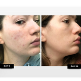 Retinal Clarity Serum