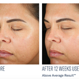 Even Intensive Skin Tone Correcting Serum