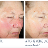 Even Intensive Skin Tone Correcting Serum
