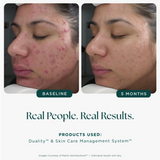 Age Intervention™ Duality™